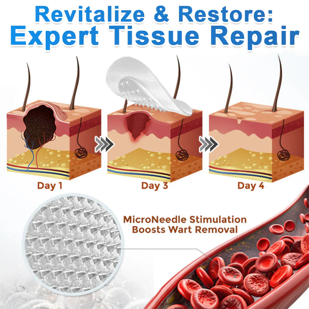 Wait — Your order is confirmed! 🎉Boost your routine with the new Hiskin® Wart Removal Patch, designed to pair with the Removal Pen for up to 200% enhanced results.👉 Add now & save 50%(Exclusive offer — only on this page)