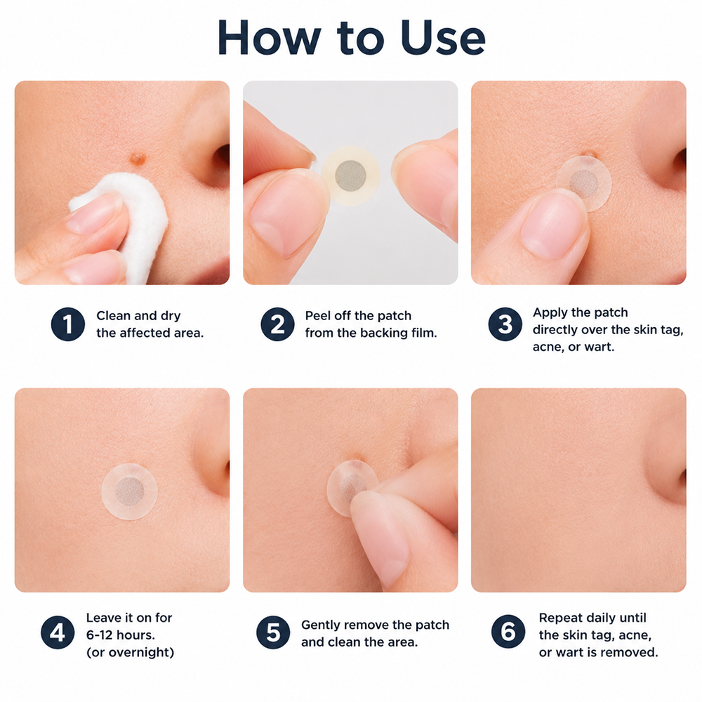 Wait — Your order is confirmed! 🎉Boost your routine with the new Hiskin® Wart Removal Patch, designed to pair with the Removal Pen for up to 200% enhanced results.👉 Add now & save 50%(Exclusive offer — only on this page)