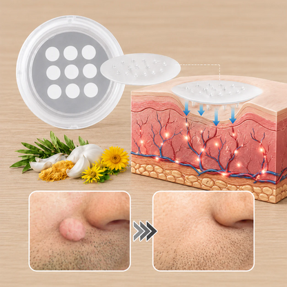 Wait — Your order is confirmed! 🎉Boost your routine with the new Hiskin® Wart Removal Patch, designed to pair with the Removal Pen for up to 200% enhanced results.👉 Add now & save 50%(Exclusive offer — only on this page)